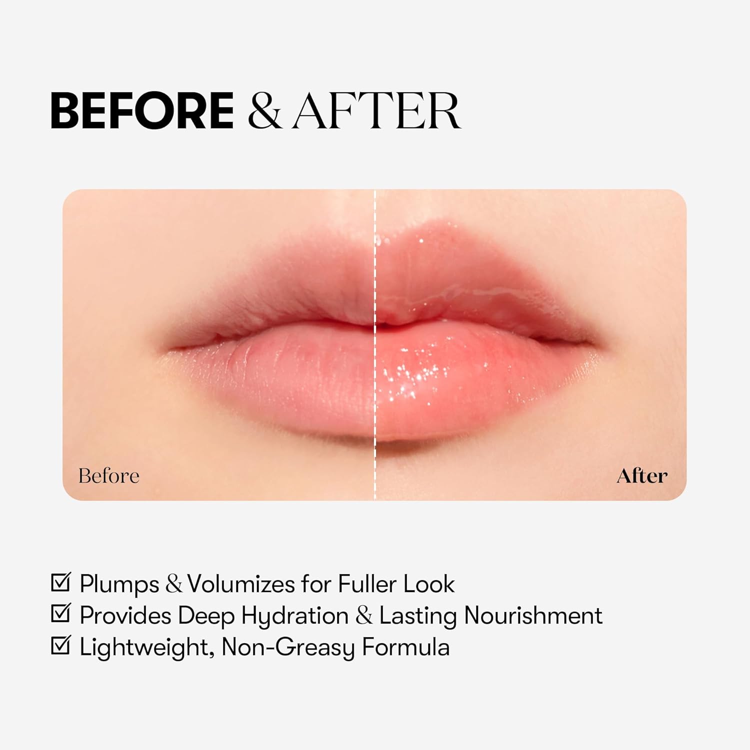 Reedle Shot Lip Plumper (Expert)